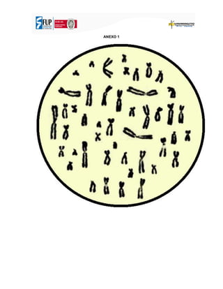 ANEXO 1
 