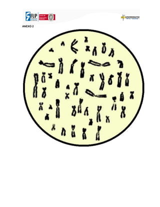 ANEXO 2
 