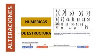 ALTERACIONES
NUMERICAS
DE ESTRUCTURA
 