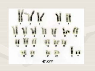 Cariótipo, euploidias e aneuploidias