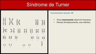 Síndrome de Turner
Cromossomos Sexuais: X0
• Única monossomia viável em humanos;
• Fêmeas fenotipicamente, mas inférteis.
 