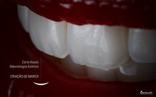 Carla Kassis
Odontologia Estética
CRIAÇÃO DE MARCA
COMUNICAÇÃO + DESIGN
 