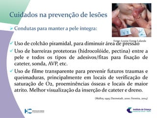 Cuidados na prevenção de lesões
 Condutas para manter a pele íntegra:

                                                     Fonte: Louise Forest-Lalande
 Uso de colchão piramidal, para diminuir área de pressão
 Uso de barreiras protetoras (hidrocolóide, pectina) entre a
  pele e todos os tipos de adesivos/fitas para fixação de
  cateter, sonda, AVP, etc.
 Uso de filme transparente para prevenir futuros traumas e
  queimaduras, principalmente em locais de verificação de
  saturação de O2, proeminências ósseas e locais de maior
  atrito. Melhor visualização da inserção de cateter e dreno.
                                     (Malloy, 1995; Darmstadt, 2000; Ferreira, 2004)
 