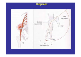 Iliopsoas
 