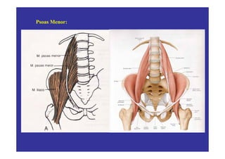 Psoas Menor:
 