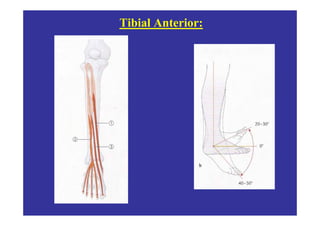 Tibial Anterior:
 