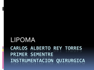 LIPOMA
CARLOS ALBERTO REY TORRES
PRIMER SEMENTRE
INSTRUMENTACION QUIRURGICA
 