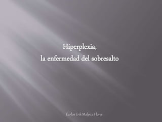 Hiperplexia,
la enfermedad del sobresalto
Carlos Erik Malpica Flores
 