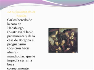 La enfermedad de los
Austias
Carlos heredó de
la casa de
Habsburgo
(Austrias) el labio
prominente y de la
casa de Borgoña el
prognatismo
(posición hacia
afuera)
mandibular, que le
impedía cerrar la
boca
correctamente.
 