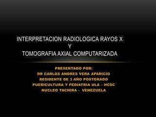 PRESENTADO POR:
DR CARLOS ANDRES VERA APARICIO
RESIDENTE DE 3 AÑO POSTGRADO
PUERICULTURA Y PEDIATRIA ULA – HCSC
NUCLEO TACHIRA - VENEZUELA
INTERPRETACION RADIOLOGICA RAYOS X
Y
TOMOGRAFIA AXIAL COMPUTARIZADA
 