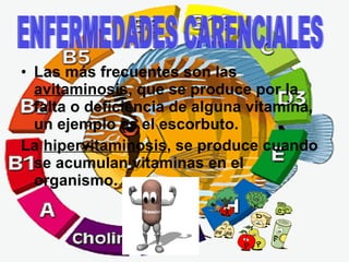 Las más frecuentes son las  avitaminosis , que se produce por la falta o deficiencia de alguna vitamina, un ejemplo es el escorbuto.  La  hipervitaminosis , se produce cuando se acumulan vitaminas en el organismo.   ENFERMEDADES CARENCIALES 