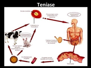 Teníase 