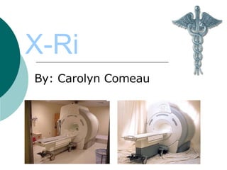 X-Ri By: Carolyn Comeau 
