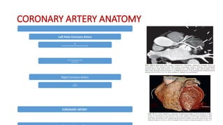 CORONARY ARTERY ANATOMY
Left Main Coronary Artery
left
anterior descending coronary artery (LAD)
left circumflex coronary
artery (LCx)
Right Coronary Artery
proximal RCA
mid-RCA
posterior descending artery.
Posterior Lateral Branch
Sinoatrial Nodal Branch
CORONARY ARTERY
 