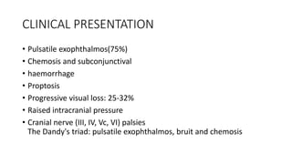 CLINICAL PRESENTATION
• Pulsatile exophthalmos(75%)
• Chemosis and subconjunctival
• haemorrhage
• Proptosis
• Progressive visual loss: 25-32%
• Raised intracranial pressure
• Cranial nerve (III, IV, Vc, VI) palsies
The Dandy's triad: pulsatile exophthalmos, bruit and chemosis
 