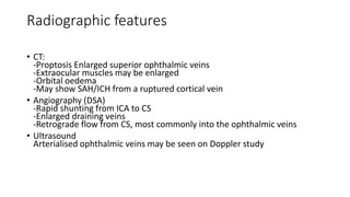 Radiographic features
• CT:
-Proptosis Enlarged superior ophthalmic veins
-Extraocular muscles may be enlarged
-Orbital oedema
-May show SAH/ICH from a ruptured cortical vein
• Angiography (DSA)
-Rapid shunting from ICA to CS
-Enlarged draining veins
-Retrograde flow from CS, most commonly into the ophthalmic veins
• Ultrasound
Arterialised ophthalmic veins may be seen on Doppler study
 