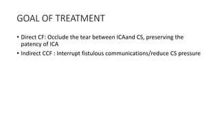 GOAL OF TREATMENT
• Direct CF: Occlude the tear between ICAand CS, preserving the
patency of ICA
• Indirect CCF : Interrupt fistulous communications/reduce CS pressure
 