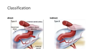 Classification
direct indirect
 