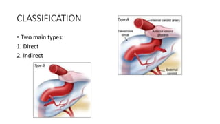 Carotico cavernous fistula and its managment | PPTX