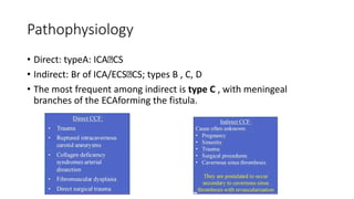 Carotico cavernous fistula and its managment | PPTX