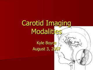 Carotid Imaging Modalities Kyle Boyce August 3, 2007 