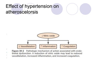 Effect of hypertension on
atheroscelorsis
 