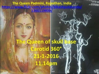 The Queen of skull base
Carotid 360°
21-1-2016
11.14pm
The Queen Padmini, Rajasthan, India
https://www.flickr.com/photos/bikashputatunda/
5360119800/
 
