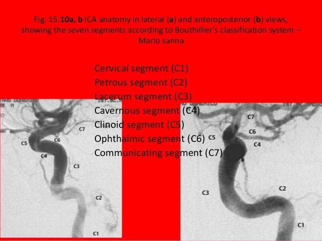 Carotid 360°