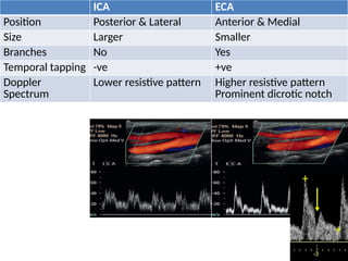 Carotid and transcranial duplex complete examination | PPTX