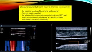 Ultrasound is currently the only mean to determine non-invasively:
• the elastic properties of the arterial wall material
(Young’s elastic modulus)
• the relationship between intima-media thickness (IMT) and
elastic properties or the influence of inward or outward
remodeling on arterial distensibility.

 