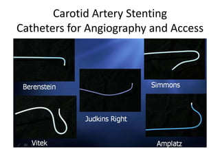 Carotid artery diseases and carotid stenting | PPTX