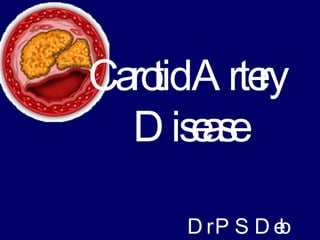 Carotid Artery Disease Dr P S Deb 