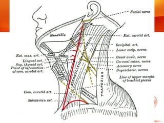Carotidas