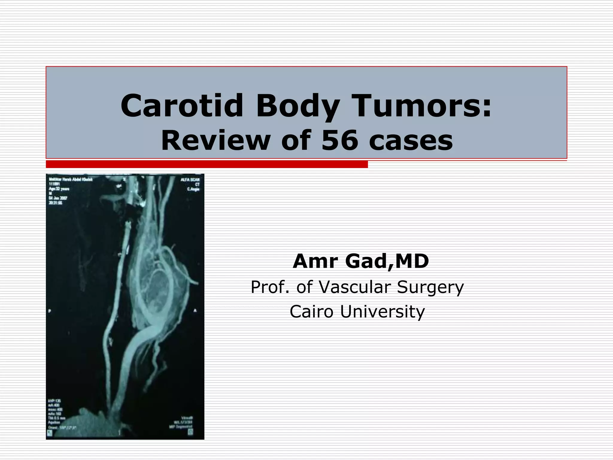 Carotid body tumors review of 56 cases | PPTX