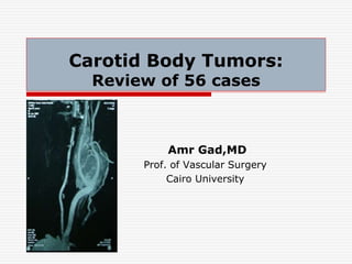 Carotid Body Tumors:
Review of 56 cases
Amr Gad,MD
Prof. of Vascular Surgery
Cairo University
 