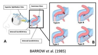 BARROW et al. (1985)
 