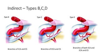 Indirect – Types B,C,D
Branches of ICA and CS Branches of ECA and CS
Branches of both ICA and
ECA and CS
 