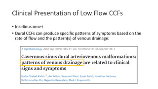 Clinical Presentation of Low Flow CCFs
• Insidious onset
• Dural CCFs can produce specific patterns of symptoms based on the
rate of flow and the pattern(s) of venous drainage:
 