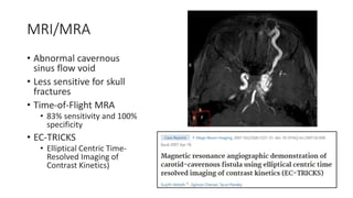 MRI/MRA
• Abnormal cavernous
sinus flow void
• Less sensitive for skull
fractures
• Time-of-Flight MRA
• 83% sensitivity and 100%
specificity
• EC-TRICKS
• Elliptical Centric Time-
Resolved Imaging of
Contrast Kinetics)
 
