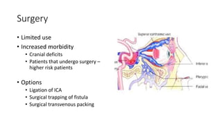 Surgery
• Limited use
• Increased morbidity
• Cranial deficits
• Patients that undergo surgery –
higher risk patients
• Options
• Ligation of ICA
• Surgical trapping of fistula
• Surgical transvenous packing
 