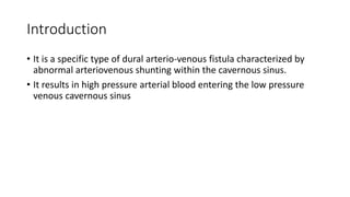 Introduction
• It is a specific type of dural arterio-venous fistula characterized by
abnormal arteriovenous shunting within the cavernous sinus.
• It results in high pressure arterial blood entering the low pressure
venous cavernous sinus
 