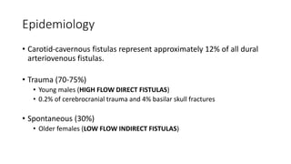 Epidemiology
• Carotid-cavernous fistulas represent approximately 12% of all dural
arteriovenous fistulas.
• Trauma (70-75%)
• Young males (HIGH FLOW DIRECT FISTULAS)
• 0.2% of cerebrocranial trauma and 4% basilar skull fractures
• Spontaneous (30%)
• Older females (LOW FLOW INDIRECT FISTULAS)
 