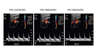 PSV-131CM/SEC PSV-190CM/SEC PSV-266CM/SEC
 