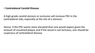 • Contralateral Carotid Disease
A high-grade carotid stenosis or occlusion will increase PSV in the
contralateral side, especially at the site of a stenosis.
Hence, if the PSV seems more elevated than one would expect given the
amount of visualized plaque and if the vessel is not tortuous, one should be
suspicious of contralateral disease.
 