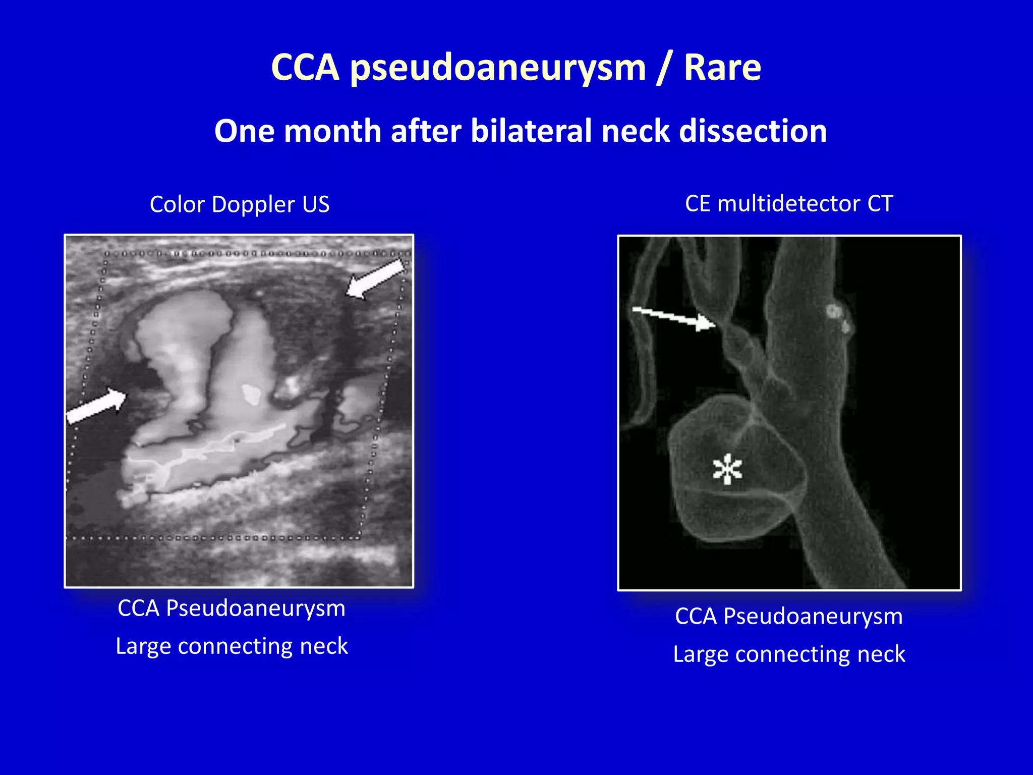 Carotid doppler II Dr. Muhammad Bin Zulfiqar | PPTX