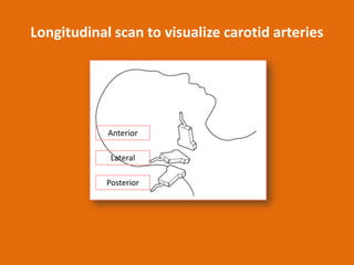Longitudinal scan to visualize carotid arteries

Anterior
Lateral
Posterior

 