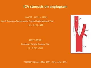 ICA stenosis on angiogram
NASCET 1 (1991 – 1998)
North American Symptomatic Carotid Endartectomy Trial

(B – A / B) x 100
...