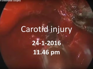 Carotid injury
23-1-2017
9.08 pm
 