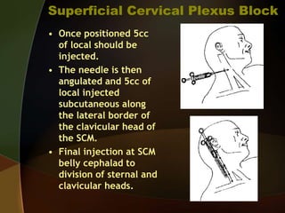 Anesthesia for Carotid Surgery | PPT