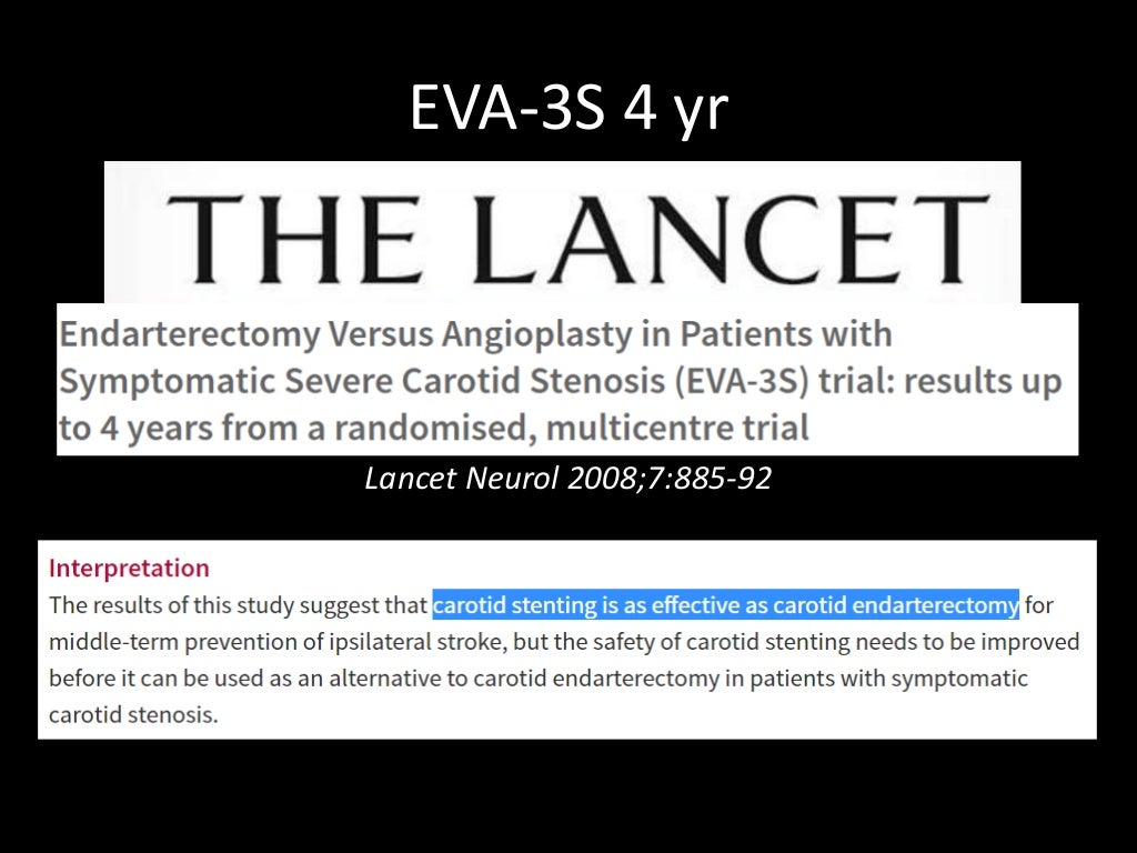 Management of Carotid Artery Stenosis Evidence and guidelines